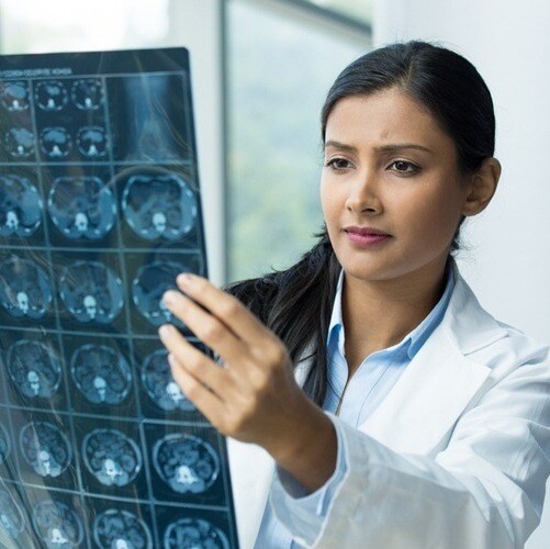 Doctor looking at brain scans in hospital